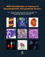 WHO klasifikace nádorů krvetvorné a lymfatické tkáně - WHO Classification of Tumours of Haematopoietic and Lymphoid Tissues