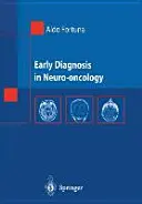 Včasná diagnostika v neuroonkologii - Early Diagnosis in Neuro-Oncology