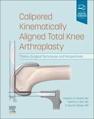Kaliperovaná kinematicky zarovnaná totální endoprotéza kolenního kloubu: Vydání knihy: Teorie, chirurgické techniky a perspektivy - Calipered Kinematically Aligned Total Knee Arthroplasty: Theory, Surgical Techniques and Perspectives