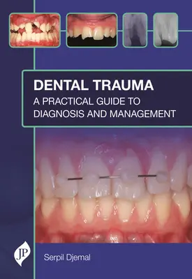 Zubní trauma: Praktický průvodce diagnostikou a léčbou - Dental Trauma: A Practical Guide to Diagnosis and Management