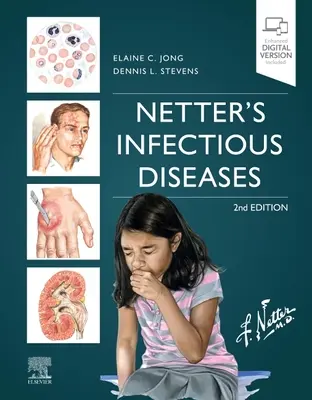 Netterovy infekční choroby - Netter's Infectious Diseases