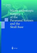 Mikroendoskopická chirurgie vedlejších nosních dutin a baze lební - Micro-Endoscopic Surgery of the Paranasal Sinuses and the Skull Base