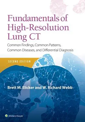 Základy CT plic s vysokým rozlišením: běžné nálezy, běžné vzorce, běžná onemocnění a diferenciální diagnostika - Fundamentals of High-Resolution Lung CT: Common Findings, Common Patterns, Common Diseases and Differential Diagnosis