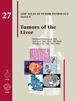 Nádory jater - Tumors of the Liver