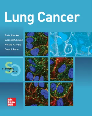 Rakovina plic: Standardy péče - Lung Cancer: Standards of Care