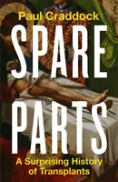 Náhradní díly - Překvapivá historie transplantací - Spare Parts - A Surprising History of Transplants
