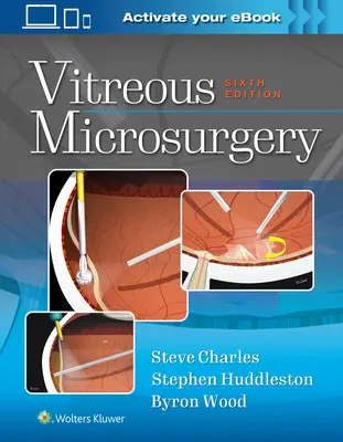 Mikrochirurgie sklivce - Vitreous Microsurgery