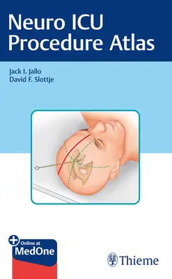 Atlas postupů na neurologické jednotce intenzivní péče - Neuro ICU Procedure Atlas