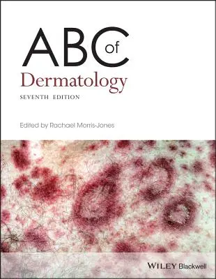 ABC dermatologie - ABC of Dermatology