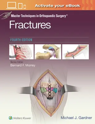 Mistrovské techniky v ortopedické chirurgii: Zlomeniny - Master Techniques in Orthopaedic Surgery: Fractures