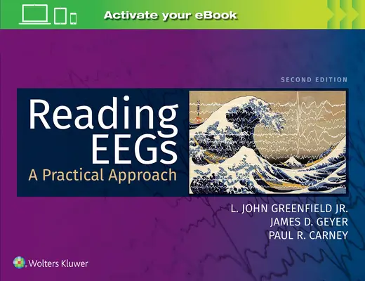 Čtení EEG: Praktický přístup - Reading Eegs: A Practical Approach