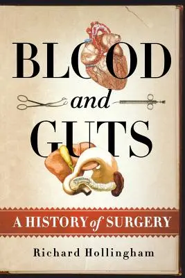 Krev a střeva: Dějiny chirurgie - Blood and Guts: A History of Surgery