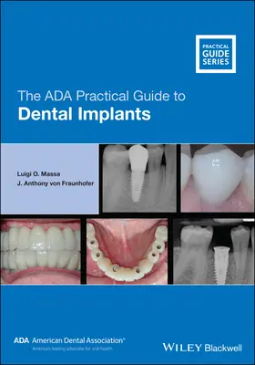 Praktický průvodce ADA pro zubní implantáty (The ADA Practical Guide to Dental Implants) - The ADA Practical Guide to Dental Implants