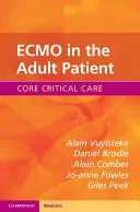 ECMO u dospělého pacienta - ECMO in the Adult Patient