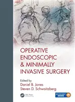 Operační endoskopická a minimálně invazivní chirurgie - Operative Endoscopic and Minimally Invasive Surgery