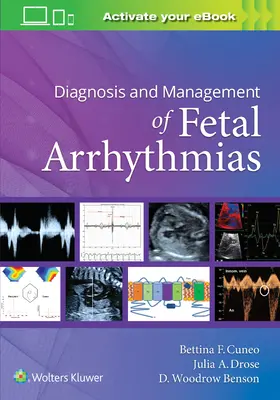 Diagnostika a léčba fetálních arytmií - Diagnosis and Management of Fetal Arrhythmias