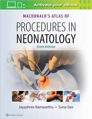Macdonaldův atlas postupů v neonatologii - Macdonald's Atlas of Procedures in Neonatology