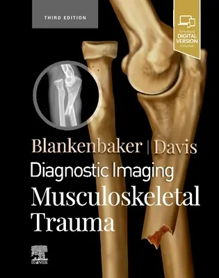 Diagnostické zobrazování: Muskuloskeletální trauma - Diagnostic Imaging: Musculoskeletal Trauma