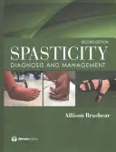 Spasticita: Diagnostika a léčba - Spasticity: Diagnosis and Management