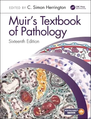 Muirova učebnice patologie - Muir's Textbook of Pathology