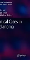 Klinické případy melanomu - Clinical Cases in Melanoma
