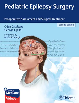 Dětská chirurgie epilepsie: Předoperační hodnocení a chirurgická léčba - Pediatric Epilepsy Surgery: Preoperative Assessment and Surgical Treatment