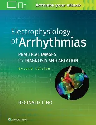 Elektrofyziologie arytmií: Praktické snímky pro diagnostiku a ablaci - Electrophysiology of Arrhythmias: Practical Images for Diagnosis and Ablation