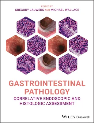 Gastrointestinální patologie: Korelační endoskopické a histologické hodnocení - Gastrointestinal Pathology: Correlative Endoscopic and Histologic Assessment