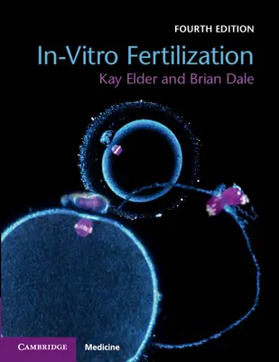 Oplodnění in vitro - In-Vitro Fertilization