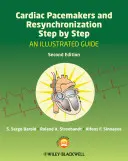 Kardiostimulátory a resynchronizace krok za krokem: Ilustrovaný průvodce - Cardiac Pacemakers and Resynchronization Step by Step: An Illustrated Guide