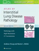 Atlas patologie intersticiálních plicních onemocnění - Atlas of Interstitial Lung Disease Pathology