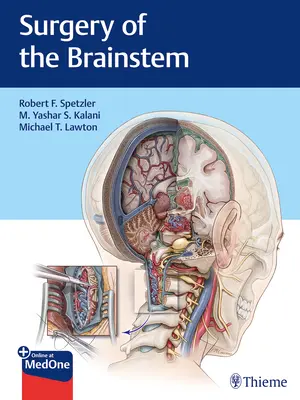Chirurgie mozkového kmene - Surgery of the Brainstem