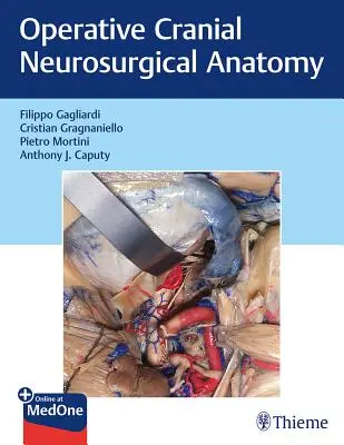 Operační kraniální neurochirurgická anatomie - Operative Cranial Neurosurgical Anatomy