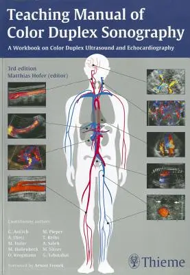 Výuková příručka barevné duplexní sonografie - Teaching Manual of Color Duplex Sonography