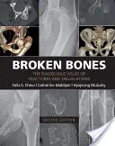 Zlomené kosti: Radiologický atlas zlomenin a vykloubení - Broken Bones: The Radiologic Atlas of Fractures and Dislocations
