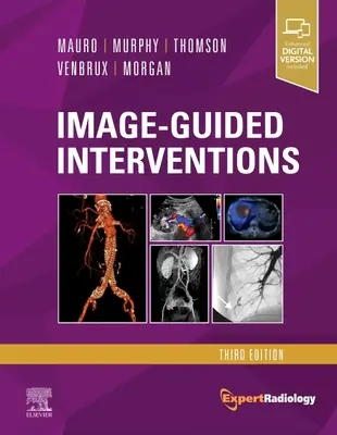 Obrazem řízené intervence: Série Expert Radiology - Image-Guided Interventions: Expert Radiology Series
