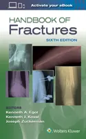 Příručka o zlomeninách - Handbook of Fractures