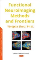 Funkční neurozobrazovací metody a jejich hranice (Functional Neuroimaging Methods and Frontiers) - Functional Neuroimaging Methods and Frontiers