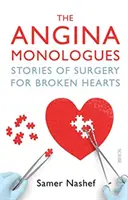 Monology o angíně - příběhy z chirurgie zlomených srdcí - Angina Monologues - stories of surgery for broken hearts