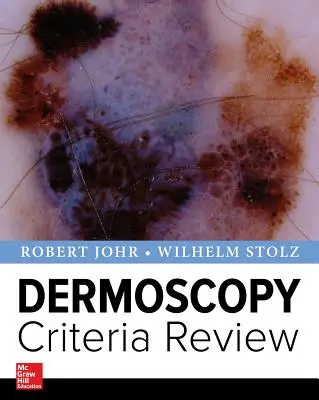 Přehled kritérií dermoskopie - Dermoscopy Criteria Review