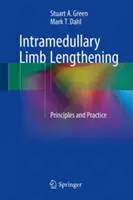 Intramedulární prodlužování končetin: Principy a praxe - Intramedullary Limb Lengthening: Principles and Practice