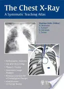 The Chest X-Ray: Systematický výukový atlas - The Chest X-Ray: A Systematic Teaching Atlas
