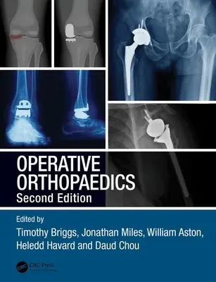Operační ortopedie - Operative Orthopaedics