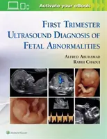 Ultrazvuková diagnostika abnormalit plodu v prvním trimestru těhotenství - First Trimester Ultrasound Diagnosis of Fetal Abnormalities