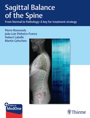 Sagitální rovnováha páteře: Od normálu k patologii: Klíč k léčebné strategii - Sagittal Balance of the Spine: From Normal to Pathology: A Key for Treatment Strategy