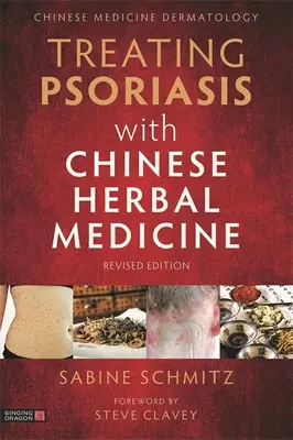 Léčba lupénky pomocí čínské bylinné medicíny (revidované vydání): Praktická příručka - Treating Psoriasis with Chinese Herbal Medicine (Revised Edition): A Practical Handbook