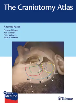 Atlas kraniotomie - The Craniotomy Atlas