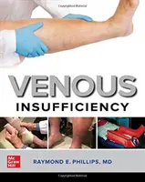 Žilní nedostatečnost - Venous Insufficiency