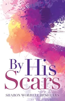 U jeho jizev - By His Scars