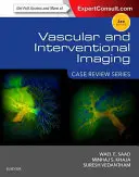 Vaskulární a intervenční zobrazování: Série přehledů případů - Vascular and Interventional Imaging: Case Review Series